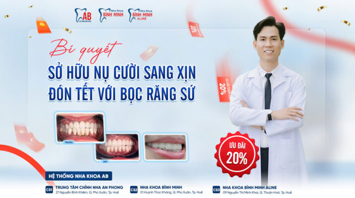Bọc Răng Sứ - Bí Quyết Sở Hữu Nụ Cười Sang Xịn Đón Tết