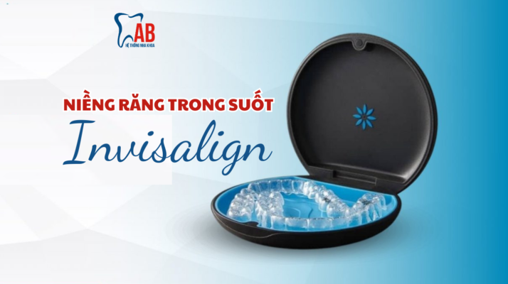 Niềng răng trong suốt Invisalign: 01 Giải pháp chỉnh nha hiện đại