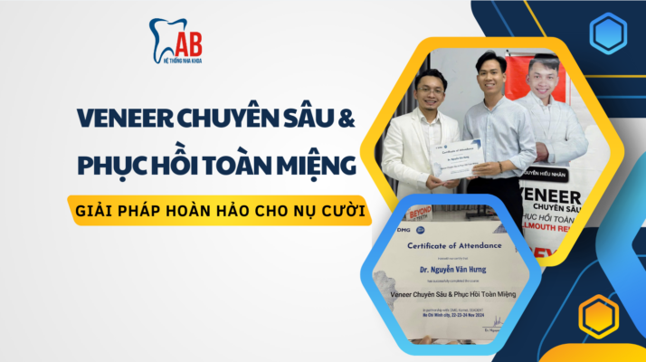 Veneer chuyên sâu & phục hồi toàn miệng - Giải pháp hoàn hảo cho nụ cười