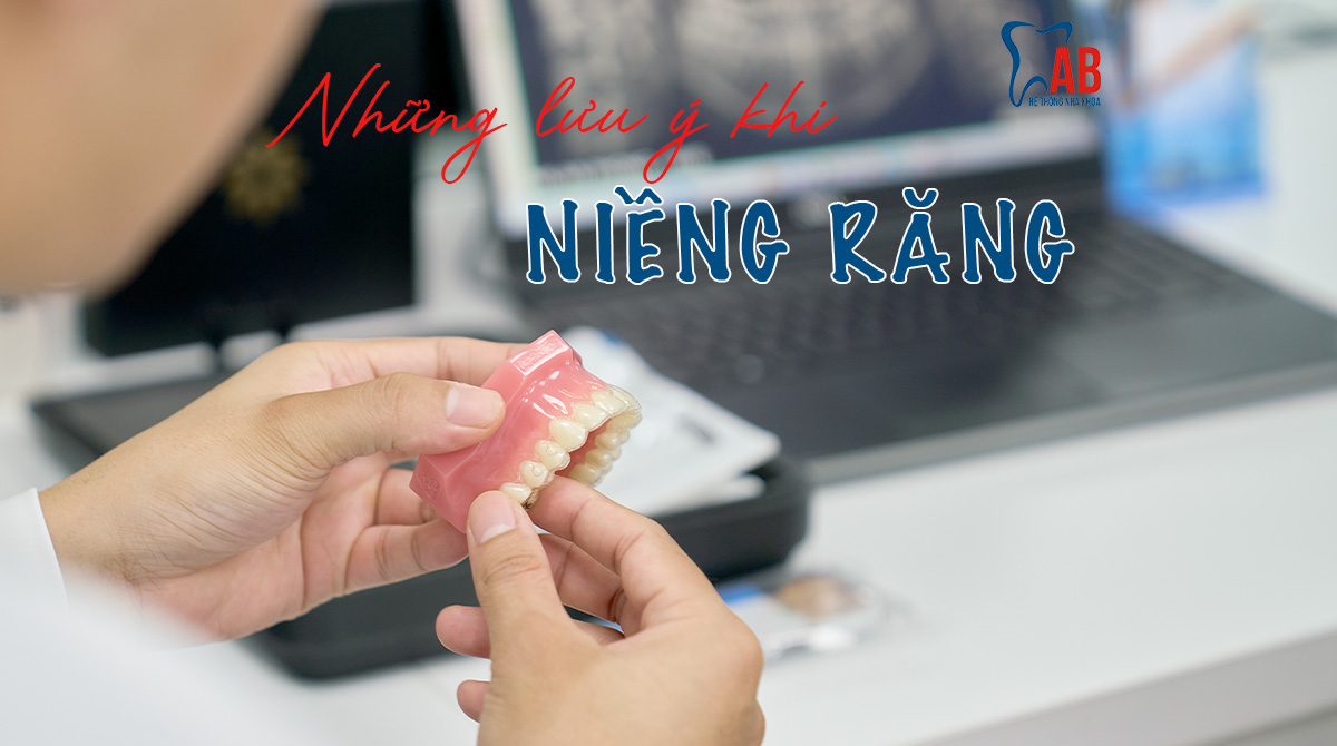 Lưu ý khi niềng răng