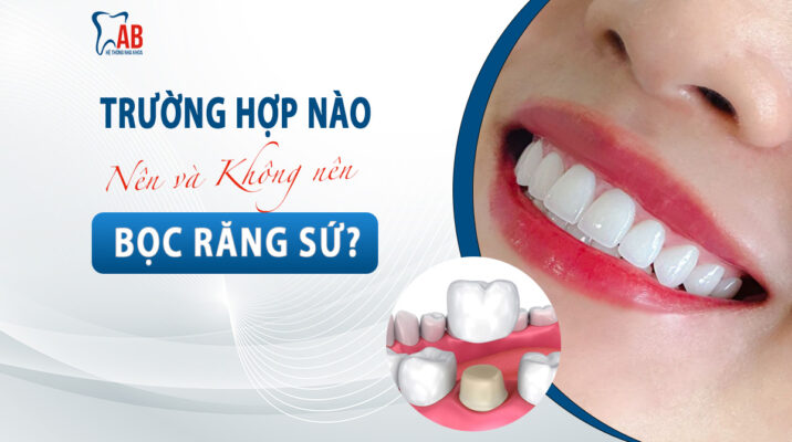 Bọc răng sứ thẩm mỹ