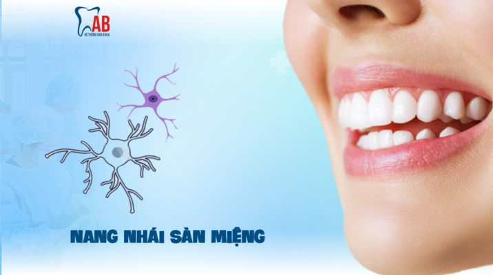Nang nhái sàn miệng