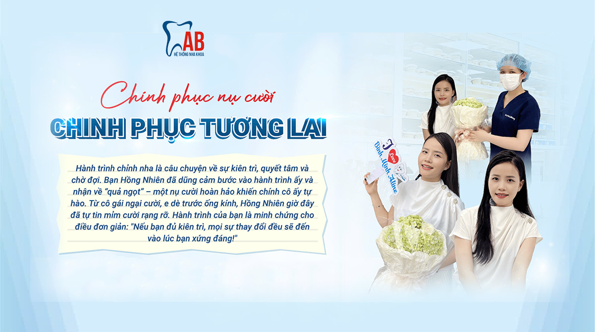 Thay đổi sau chỉnh nha Hồng Nhiên