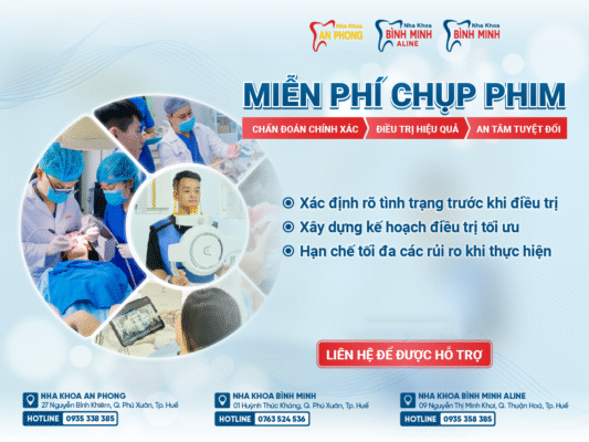 Chụp phim miễn phí